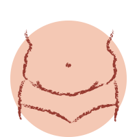 Icon Incha&ccedil;o Abdominal 