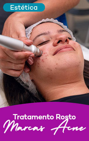 Carrossel Hub Mulher - Marcas Acne