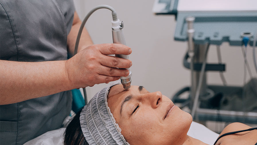 Microdermoabras&atilde;o